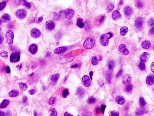 Zooming, note the irregular cell- and nucleus-shapes