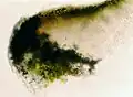 Photograph of a section of an apothecium of A. cinerea taken through a compound microscope (x400) showing algae in the amphithecium of the thalline margin. (Lecanorine-type apothecium)