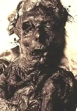 The Borremose Man around the time of his discovery