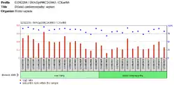 CXorf66 Protein Presence in Dilated Cardiomyopathy Septum Tissue