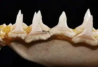 Lower teeth