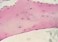 Bone, cell nuclei (blue-purple), bone matrix (pink)