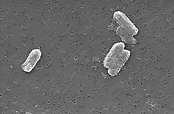 "Citrobacter freundii"