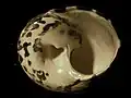 view from below; the umbilicus is clearly visible
