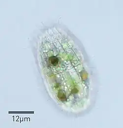 Micrograph of a Coleps specimen