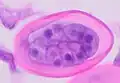 Cross-section of early E. vermicularis egg, H&E stain