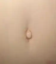 An outie navel