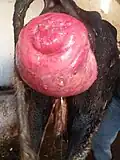 recent case, emptying with one needle