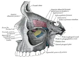 Medial wall of left orbit