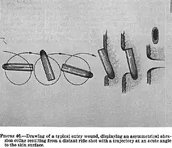 An illustration shows the bullet, which had hit Kennedy a moment before, rotating and tumbling before entering Connally's skin, causing his entry wound.