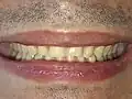 Front view of the teeth