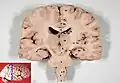 Human brain frontal (coronal) section. Thalamus label is 10.