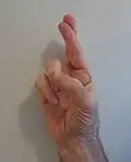 R