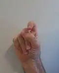 X