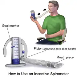 An incentive spirometer, a clear plastic medical device with blue base, yellow ball inside tube, measures inhalation volume.