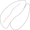 Intragranular crack