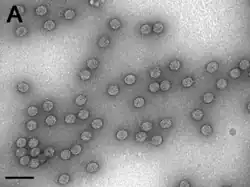 Transmission electron micrograph of Cauliflower mosaic virus