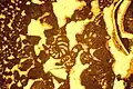 Aerial, supratidal (vadose) diagenesis in a carbonate sand with foraminifera displaced by tidal currents and storm waves on the shelf
