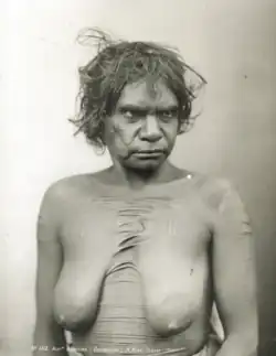Portrait photograph of a shirtless Aboriginal woman with a scarred torso