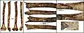 Burial 15. Perimortem fracture on the right humerus.