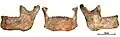 Burial 17 - The mandiblewas within the skullcap. Teeth were intentionally removed and burnt marks are limited to the alveolar margin.