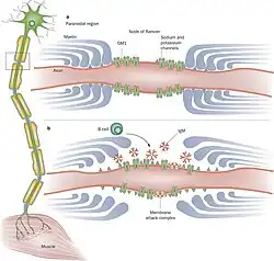 MMN scheme