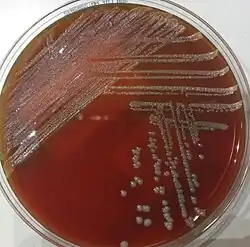 Massilia timonae blood agar