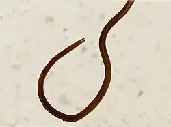 parasite against a white background, think and dark in a loop shape