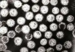 Transmission electron micrograph of rotavirus virions