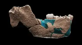 Mandible (lower jaw)