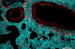 Neutrophils accumulate in the alveoli of a lung infected with influenza. Image at a scale of 50 nanometres (one nanometre is one millionth of a millimeter)
