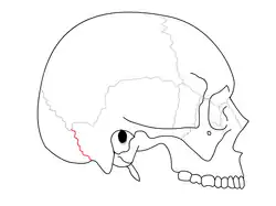 Occipitomastoid suture. It separates occipital bone and mastoid portion of temporal bone.