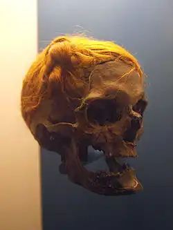 Preserved head of Osterby Man