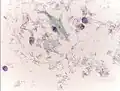 The cytoplasms of squamous epithelial cells melted out; many Döderlein bacilli can be seen.
