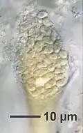 Club-shaped, polysporous ascus, a key microscopic feature of the species (scale bar: 10 μm).