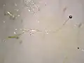 Phycomyces blakesleeanus asexual sporangium