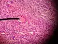 transitional primary follicle.