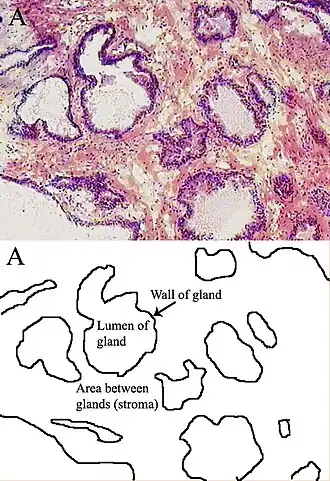 Microscopic glands of the prostate