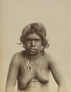Portrait photograph of a shirtless Aboriginal woman with a scarred torso