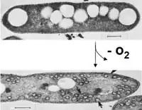 Rhodobacter sphaeroides