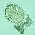 Schistosoma mekongi