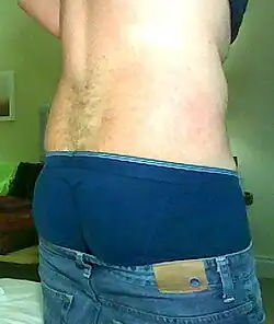 Sagging