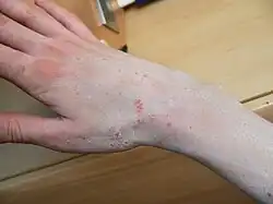 Day 4