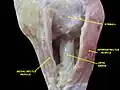 Optic nerve. Deep dissection. Inferior view.