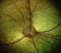 Image 39The dog's retina shows the optic disc and the eye's vasculature. (from Dog anatomy)