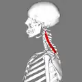 Lateral view.