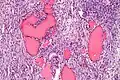 Higher magnification