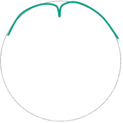 Three-turn