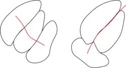 Transgranular crack