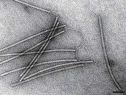 Electron micrograph of SIRV8, a rudivirus.